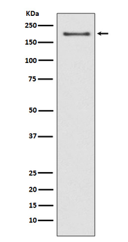 NSD3 Recombinant Rabbit Monoclonal Antibody