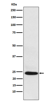 BAG2 Recombinant Rabbit Monoclonal Antibody