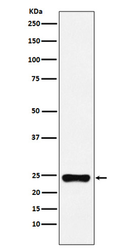 BAG2 Recombinant Rabbit Monoclonal Antibody