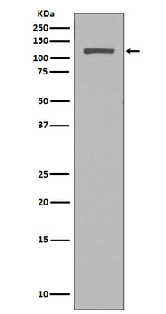 NUP98 Recombinant Rabbit Monoclonal Antibody