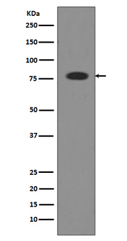 Transferrin Recombinant Rabbit Monoclonal Antibody