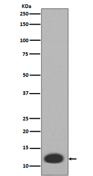 S100A8 Recombinant Rabbit Monoclonal Antibody