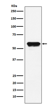 Angiotensinogen Recombinant Rabbit Monoclonal Antibody