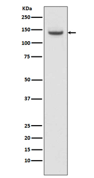 TACC3 Recombinant Rabbit Monoclonal Antibody