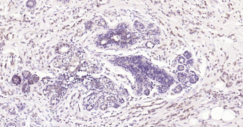 Caspase-3 Recombinant Rabbit Monoclonal Antibody