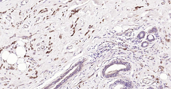STMN1 Mouse Monoclonal Antibody