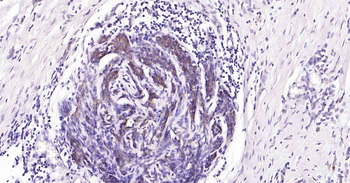 Tau-4 Mouse Monoclonal Antibody
