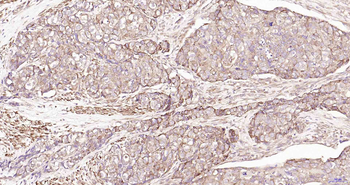ULK1 Recombinant Rabbit Monoclonal Antibody