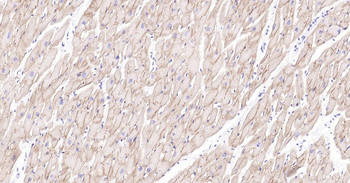 Dystrophin Recombinant Rabbit Monoclonal Antibody