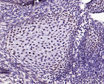 DMP1 Rabbit Polyclonal Antibody