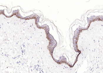 CD1A Recombinant Rabbit Monoclonal Antibody