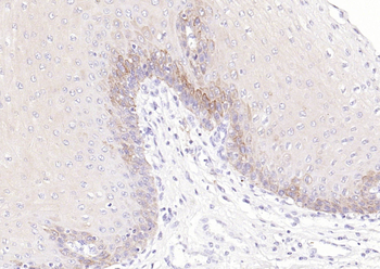 CD1A Recombinant Rabbit Monoclonal Antibody