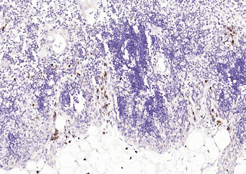 CD80 Mouse Monoclonal Antibody