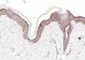 CD138 Recombinant Rabbit Monoclonal Antibody