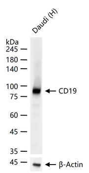CD19 Recombinant Rabbit Monoclonal Antibody