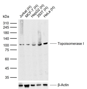 Topoisomerase I Recombinant Rabbit Monoclonal Antibody