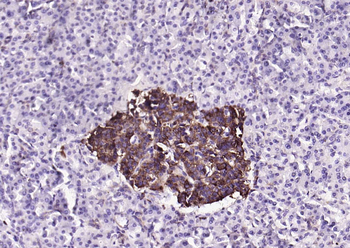 Insulin Rabbit Polyclonal Antibody