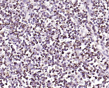 HAVCR2/TIM-3 Mouse Monoclonal Antibody