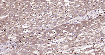 Beclin 1 Recombinant Rabbit Monoclonal Antibody