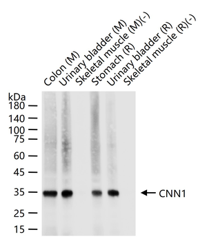 CNN1 Recombinant Rabbit Monoclonal Antibody