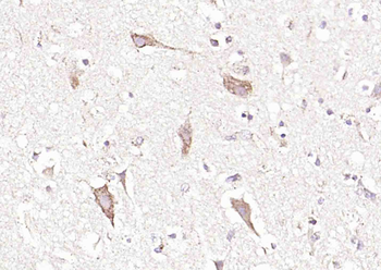SLC44A1 Rabbit Polyclonal Antibody