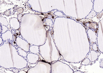 Procalcitonin (PCT) Mouse Monoclonal Antibody