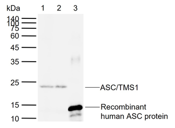 ASC/TMS1 Rabbit Polyclonal Antibody