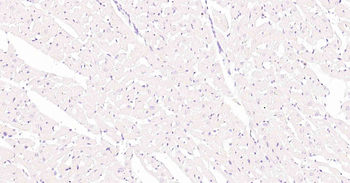 Ki67 Recombinant Rabbit Monoclonal Antibody