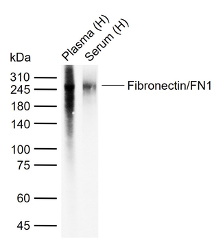 Fibronectin/FN1 Mouse Monoclonal Antibody