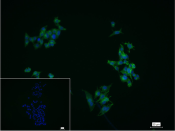 Procalcitonin (PCT) Mouse Monoclonal Antibody
