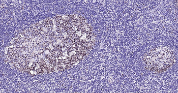 PCNA Rabbit Polyclonal Antibody