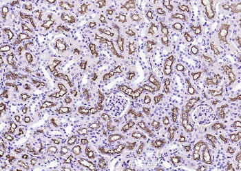 LRP2 Rabbit Polyclonal Antibody