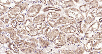 Proteasome 19S S5A Rabbit Polyclonal Antibody