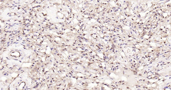 Proteasome 19S S5A Rabbit Polyclonal Antibody