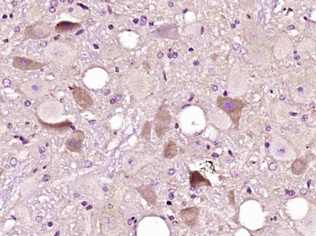 PANK4 Rabbit Polyclonal Antibody
