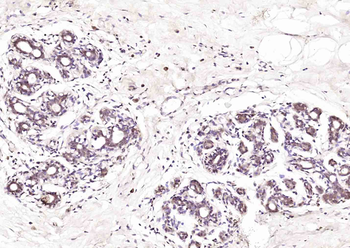 Galectin 12 Rabbit Polyclonal Antibody