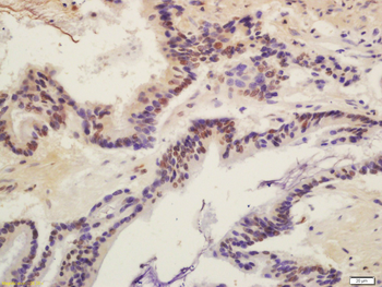 BRLF1 Rabbit Polyclonal Antibody