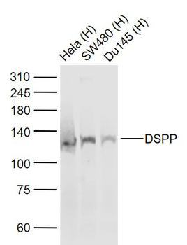 DSPP Rabbit Polyclonal Antibody