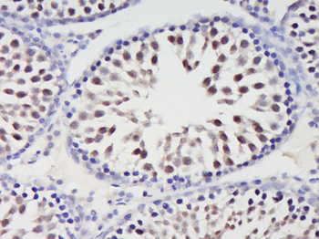 HSPB7 Rabbit Polyclonal Antibody