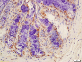 KCTD5 Rabbit Polyclonal Antibody
