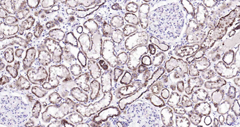 DHFR Rabbit Polyclonal Antibody