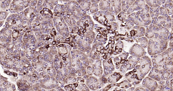 DHFR Rabbit Polyclonal Antibody