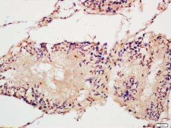 ACF1 Rabbit Polyclonal Antibody