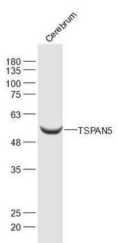 TSPAN5 Rabbit Polyclonal Antibody