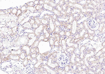 C1orf149 Rabbit Polyclonal Antibody