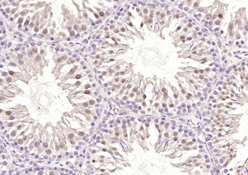 RNF210 Rabbit Polyclonal Antibody