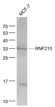 RNF210 Rabbit Polyclonal Antibody