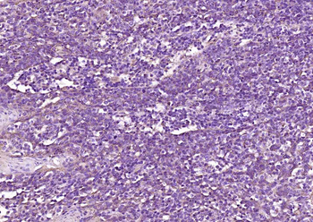 BIN2 Rabbit Polyclonal Antibody