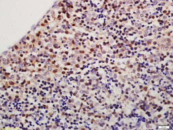TXNDC9 Rabbit Polyclonal Antibody