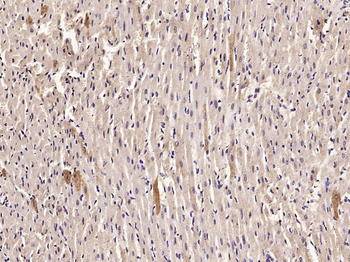 Calponin 1 + 2 + 3 Rabbit Polyclonal Antibody